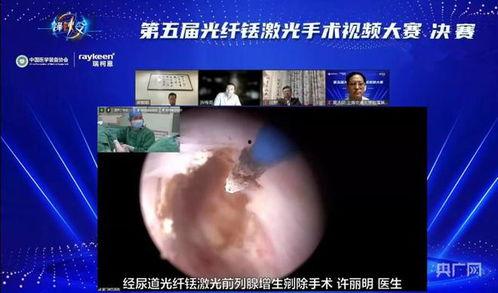 激光手术视频,精准微创，见证科技力量