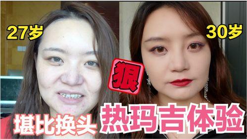 热玛吉视频,视频解析效果与原理