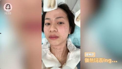 热玛吉视频,视频解析效果与原理