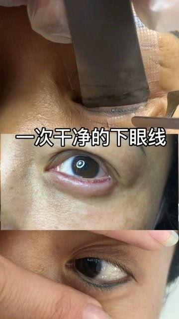 洗眼线视频,告别眼部困扰