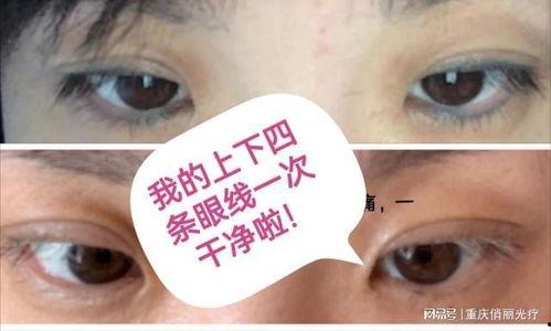 洗眼线视频,告别眼部困扰