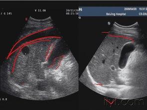 b超视频,胎儿成长轨迹全记录